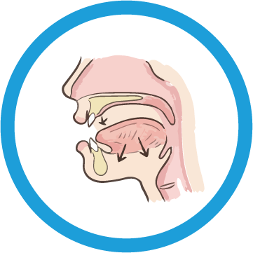 過蓋咬合・歯が歯列から飛び出しデコボコしている